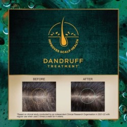 Indulekha Svetakutaja Oilayurvedic Medicinal Oil for Dandruff