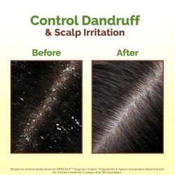 Mamaearth Lemon Anti-Dandruff Hair Oil for Flaky Scalp Scalp
