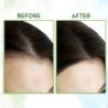 Mamaearth Rosemary Essential Oil for Hair Growth - 100% Pure