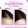 Mamaearth Rosemary Hair Growth Oil with Rosemary & Methi Dana