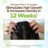 Mamaearth Rosemary Hair Scalp Serum with 95% Pure Rosemary